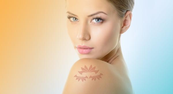 Tattoo Removal With Q-Swich Laser Treatment